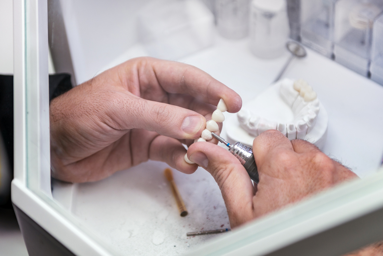 Prosthetic dentistry closeup work