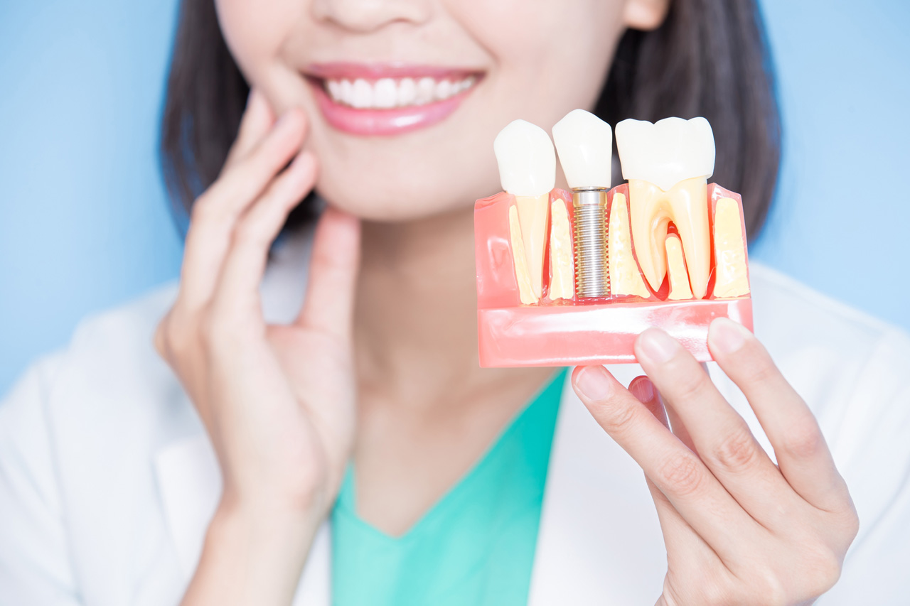 implant tooth