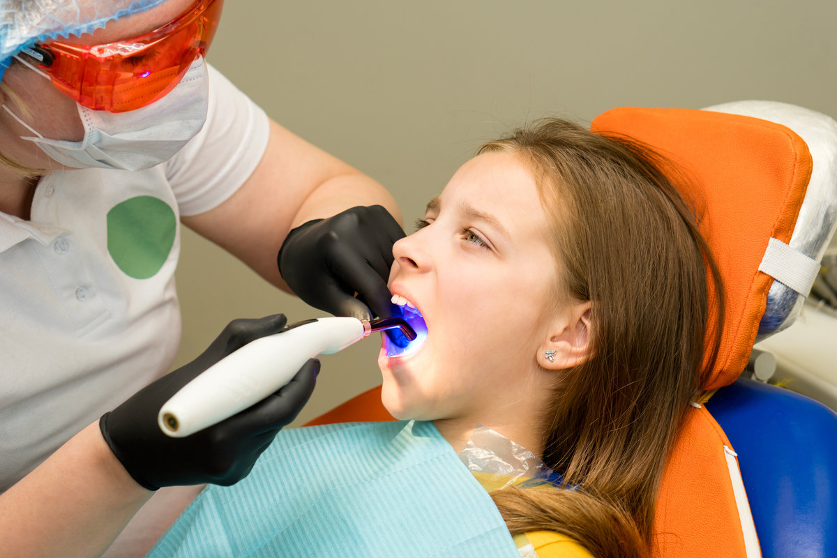 Dental polymerization UV lamp in oral cavity