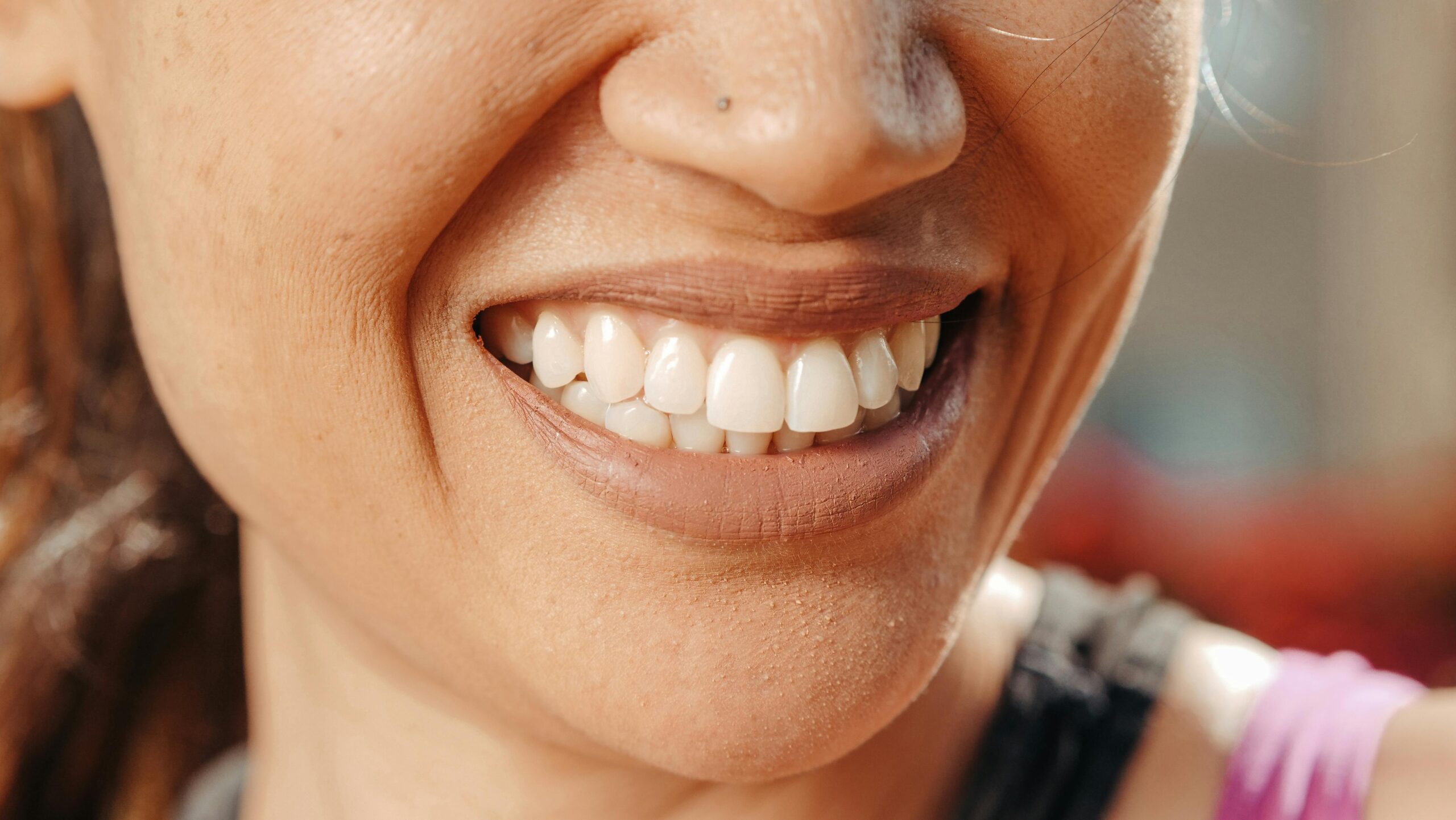 Close-Up-Photo-of-Persons-Smile-scaled