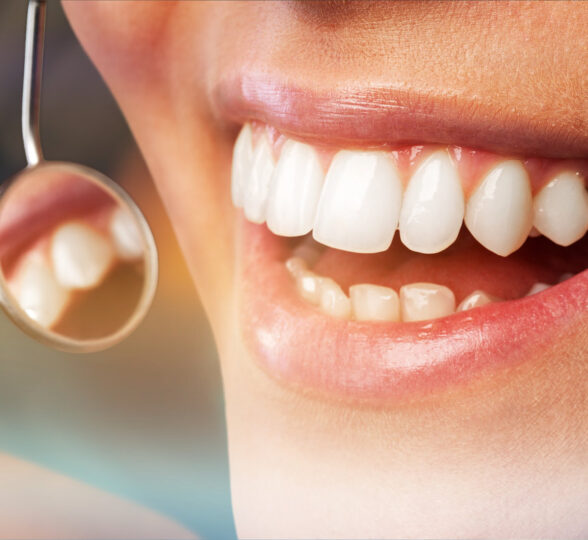 Odontology periodontal attractive teenager beautiful girl