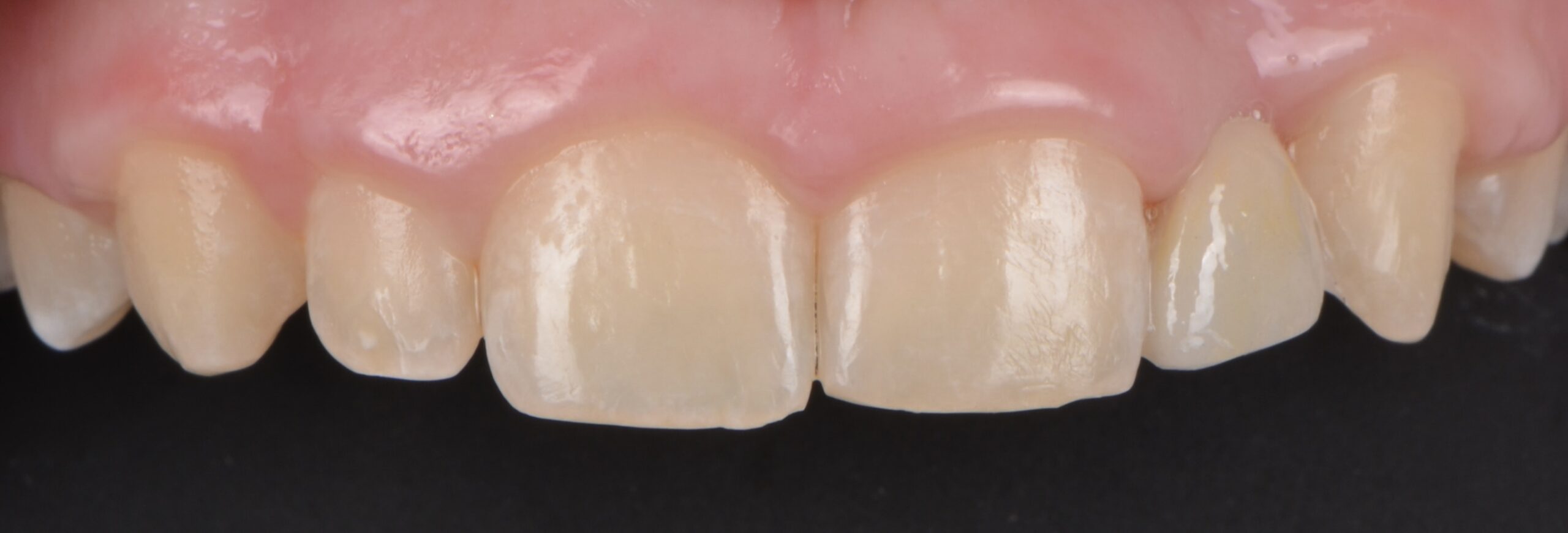 GJ2 scaled - Dental West NYC
